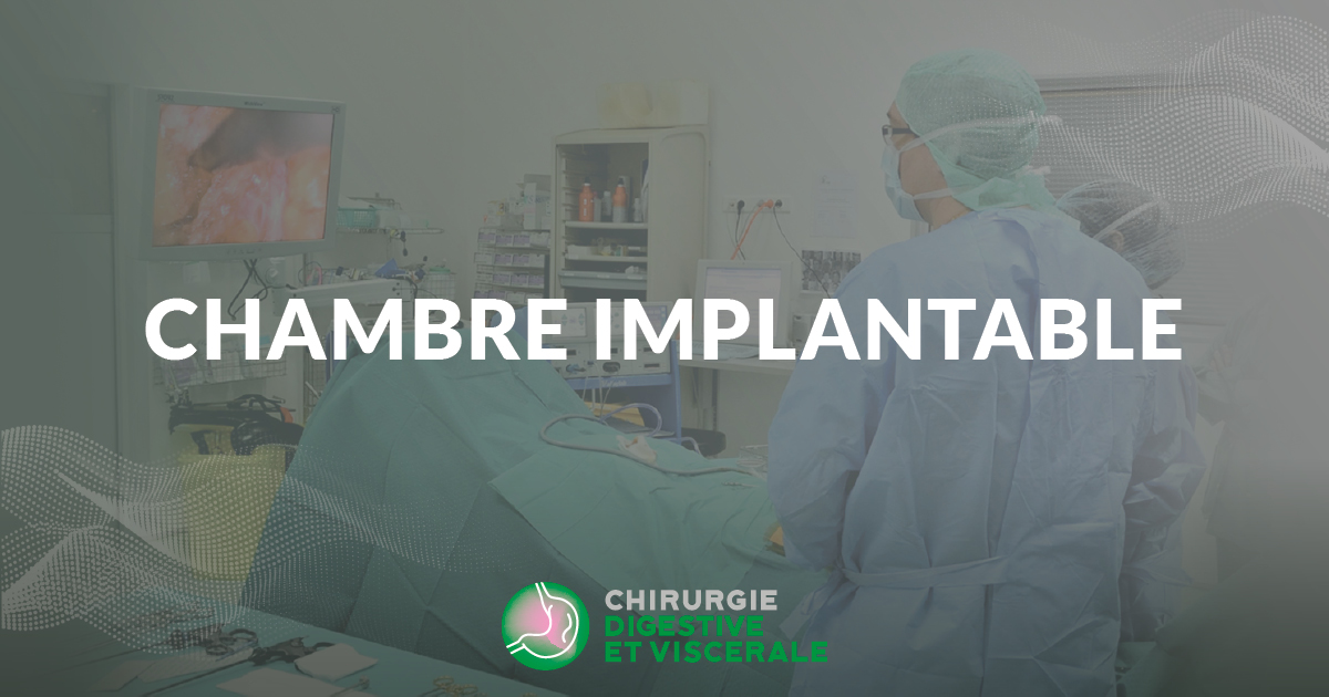 Chambre implantable Clinique chirurgie digestive royan