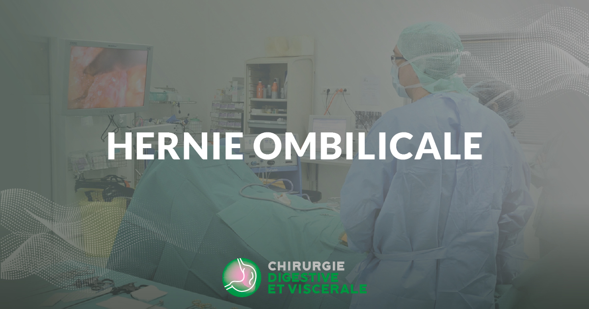 hernie ombilicale Clinique chirurgie digestive royan